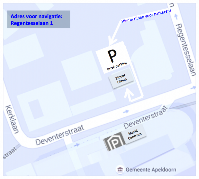 Parkeren Apeldoorn